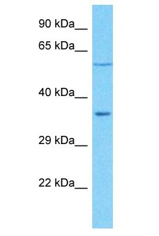 OR5R1 Antibody - OR5R1 antibody Western Blot of HeLa. Antibody dilution: 1 ug/ml.  This image was taken for the unconjugated form of this product. Other forms have not been tested.