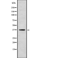 OR5R1 Antibody - Western blot analysis OR5R1 using HeLa whole cells lysates