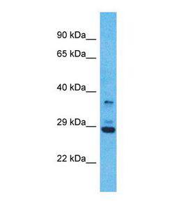 OR5V1 Antibody - Western blot of Human MCF7. OR5V1 antibody dilution 1.0 ug/ml.  This image was taken for the unconjugated form of this product. Other forms have not been tested.