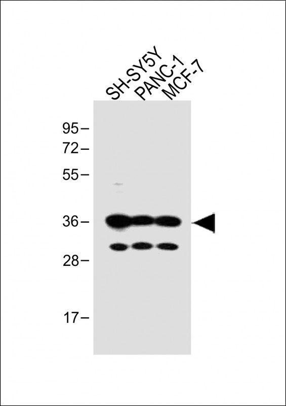OR5V1 Antibody - All lanes: Anti-OR5V1 Antibody (C-term) at 1:1000 dilution Lane 1: SH-SY5Y whole cell lysate Lane 2: PANC-1 whole cell lysate Lane 3: MCF-7 whole cell lysate Lysates/proteins at 20 µg per lane. Secondary Goat Anti-Rabbit IgG, (H+L), Peroxidase conjugated at 1/10000 dilution. Predicted band size: 36 kDa Blocking/Dilution buffer: 5% NFDM/TBST.