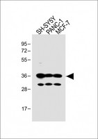 OR5V1 Antibody - All lanes: Anti-OR5V1 Antibody (C-term) at 1:1000 dilution Lane 1: SH-SY5Y whole cell lysate Lane 2: PANC-1 whole cell lysate Lane 3: MCF-7 whole cell lysate Lysates/proteins at 20 µg per lane. Secondary Goat Anti-Rabbit IgG, (H+L), Peroxidase conjugated at 1/10000 dilution. Predicted band size: 36 kDa Blocking/Dilution buffer: 5% NFDM/TBST.