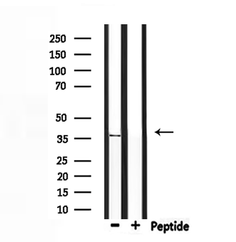 OR5V1 Antibody - Western blot analysis of extracts of rat muscle using OR5V1 antibody.