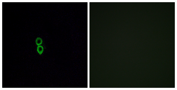 OR5W2 Antibody - Immunofluorescence analysis of A549 cells, using OR5W2 Antibody. The picture on the right is blocked with the synthesized peptide.