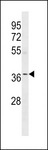 OR5W2 Antibody - OR5W2 Antibody western blot of human Uterus tissue lysates (35 ug/lane). The OR5W2 antibody detected the OR5W2 protein (arrow).