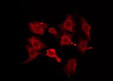 OR5W2 Antibody - Staining HeLa cells by IF/ICC. The samples were fixed with PFA and permeabilized in 0.1% Triton X-100, then blocked in 10% serum for 45 min at 25°C. The primary antibody was diluted at 1:200 and incubated with the sample for 1 hour at 37°C. An Alexa Fluor 594 conjugated goat anti-rabbit IgG (H+L) Ab, diluted at 1/600, was used as the secondary antibody.