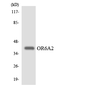 OR6A2 Antibody - Western blot analysis of the lysates from HeLa cells using OR6A2 antibody.