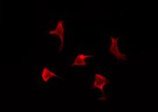 OR6A2 Antibody - Staining HeLa cells by IF/ICC. The samples were fixed with PFA and permeabilized in 0.1% Triton X-100, then blocked in 10% serum for 45 min at 25°C. The primary antibody was diluted at 1:200 and incubated with the sample for 1 hour at 37°C. An Alexa Fluor 594 conjugated goat anti-rabbit IgG (H+L) Ab, diluted at 1/600, was used as the secondary antibody.