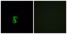OR6B2 Antibody - Immunofluorescence analysis of MCF7 cells, using OR6B2 Antibody. The picture on the right is blocked with the synthesized peptide.