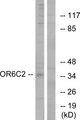 OR6C2 Antibody - Western blot analysis of extracts from HT-29 cells, using OR6C2 antibody.