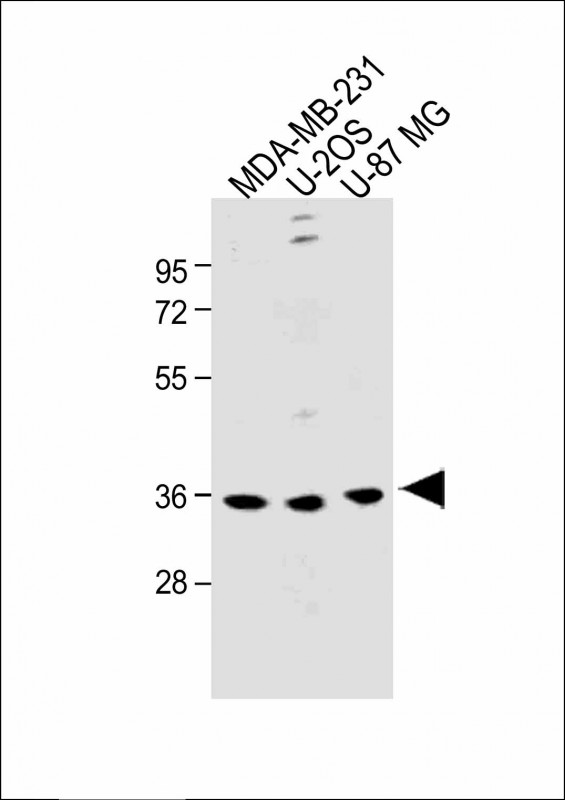 OR6C3 Antibody - All lanes: Anti-OR6C3 Antibody (Center) at 1:1000 dilution Lane 1: MDA-MB-231 whole cell lysate Lane 2: U-2OS whole cell lysate Lane 3: U-87 MG whole cell lysate Lysates/proteins at 20 µg per lane. Secondary Goat Anti-Rabbit IgG, (H+L), Peroxidase conjugated at 1/10000 dilution. Predicted band size: 36 kDa Blocking/Dilution buffer: 5% NFDM/TBST.