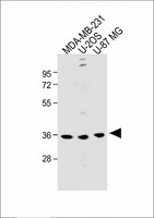 OR6C3 Antibody - All lanes: Anti-OR6C3 Antibody (Center) at 1:1000 dilution Lane 1: MDA-MB-231 whole cell lysate Lane 2: U-2OS whole cell lysate Lane 3: U-87 MG whole cell lysate Lysates/proteins at 20 µg per lane. Secondary Goat Anti-Rabbit IgG, (H+L), Peroxidase conjugated at 1/10000 dilution. Predicted band size: 36 kDa Blocking/Dilution buffer: 5% NFDM/TBST.