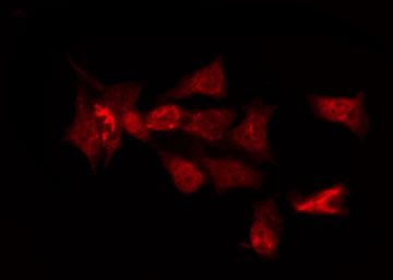 OR6C3 Antibody - Staining HeLa cells by IF/ICC. The samples were fixed with PFA and permeabilized in 0.1% Triton X-100, then blocked in 10% serum for 45 min at 25°C. The primary antibody was diluted at 1:200 and incubated with the sample for 1 hour at 37°C. An Alexa Fluor 594 conjugated goat anti-rabbit IgG (H+L) Ab, diluted at 1/600, was used as the secondary antibody.