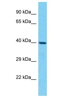 OR6C6 Antibody - OR6C6 antibody Western Blot of Jurkat. Antibody dilution: 1 ug/ml.  This image was taken for the unconjugated form of this product. Other forms have not been tested.