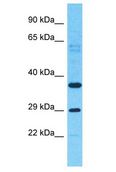 OR6C6 Antibody - OR6C6 antibody Western Blot of NCI-H226. Antibody dilution: 1 ug/ml.  This image was taken for the unconjugated form of this product. Other forms have not been tested.