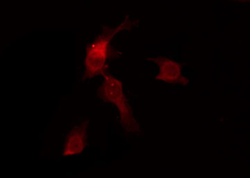 OR6C68 Antibody - Staining HuvEc cells by IF/ICC. The samples were fixed with PFA and permeabilized in 0.1% Triton X-100, then blocked in 10% serum for 45 min at 25°C. The primary antibody was diluted at 1:200 and incubated with the sample for 1 hour at 37°C. An Alexa Fluor 594 conjugated goat anti-rabbit IgG (H+L) Ab, diluted at 1/600, was used as the secondary antibody.