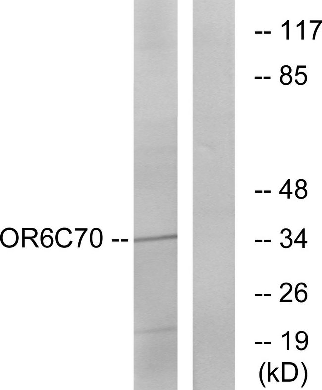 OR6C70 Antibody - Western blot analysis of lysates from Jurkat cells, using OR6C70 Antibody. The lane on the right is blocked with the synthesized peptide.