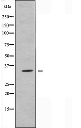 OR6C70 Antibody - Western blot analysis of extracts of Jurkat cells using OR6C70 antibody.