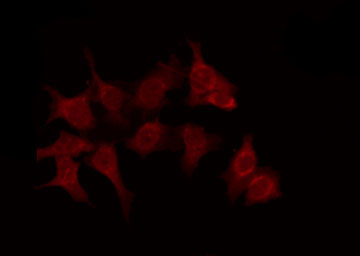 OR6C70 Antibody - Staining HeLa cells by IF/ICC. The samples were fixed with PFA and permeabilized in 0.1% Triton X-100, then blocked in 10% serum for 45 min at 25°C. The primary antibody was diluted at 1:200 and incubated with the sample for 1 hour at 37°C. An Alexa Fluor 594 conjugated goat anti-rabbit IgG (H+L) Ab, diluted at 1/600, was used as the secondary antibody.