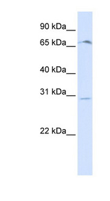 OR6C75 Antibody - OR6C75 antibody Western blot of Placenta lysate. This image was taken for the unconjugated form of this product. Other forms have not been tested.