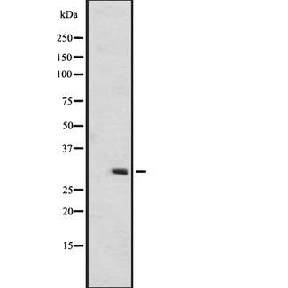 OR6C75 Antibody - Western blot analysis of OR6C75 expression in A431 whole cells lysate. The lane on the left is treated with the antigen-specific peptide.