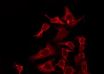OR6J1 Antibody - Staining HuvEc cells by IF/ICC. The samples were fixed with PFA and permeabilized in 0.1% Triton X-100, then blocked in 10% serum for 45 min at 25°C. The primary antibody was diluted at 1:200 and incubated with the sample for 1 hour at 37°C. An Alexa Fluor 594 conjugated goat anti-rabbit IgG (H+L) Ab, diluted at 1/600, was used as the secondary antibody.