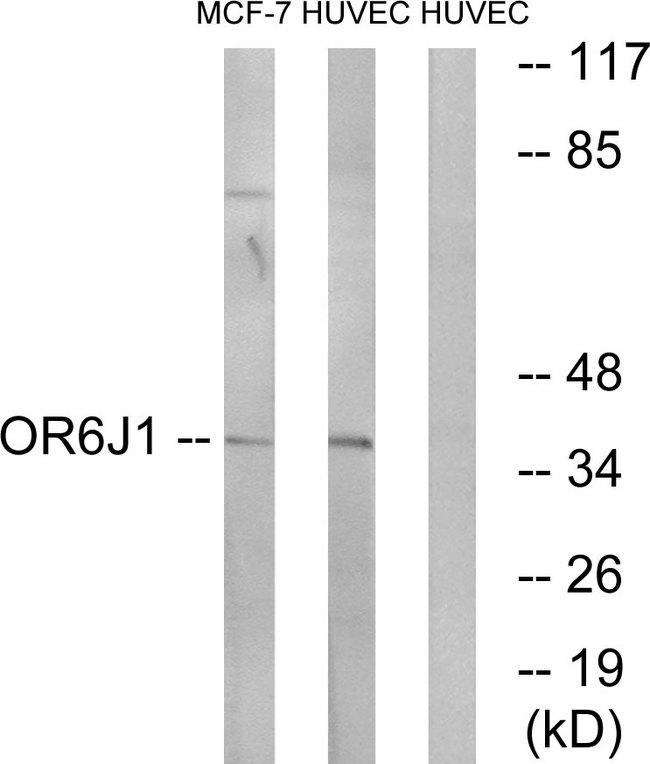 OR6J1 Antibody - Western blot analysis of extracts from MCF-7 cells and HUVEC cells, using OR6J1 antibody.