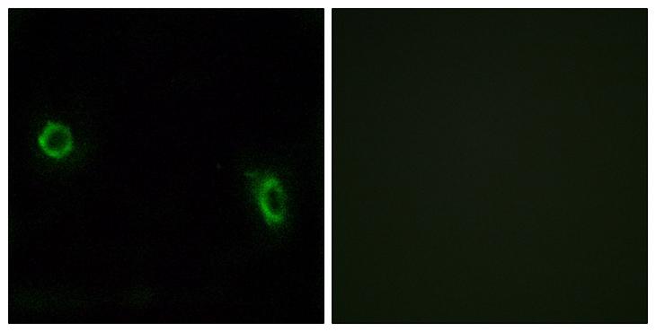 OR6J1 Antibody - Peptide - + Immunofluorescence analysis of MCF-7 cells, using OR6J1 antibody.