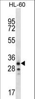 OR6K2 Antibody - OR6K2 Antibody western blot of HL-60 cell line lysates (35 ug/lane). The OR6K2 antibody detected the OR6K2 protein (arrow).