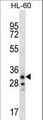 OR6K2 Antibody - OR6K2 Antibody western blot of HL-60 cell line lysates (35 ug/lane). The OR6K2 antibody detected the OR6K2 protein (arrow).