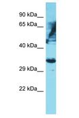 OR6K2 Antibody - OR6K2 antibody Western Blot of HeLa. Antibody dilution: 1 ug/ml.  This image was taken for the unconjugated form of this product. Other forms have not been tested.