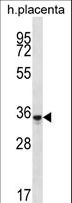 OR6K6 Antibody - OR6K6 Antibody western blot of human placenta tissue lysates (35 ug/lane). The OR6K6 antibody detected the OR6K6 protein (arrow).