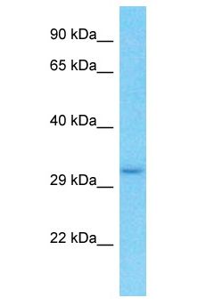OR6M1 Antibody - OR6M1 antibody Western Blot of HT1080. Antibody dilution: 1 ug/ml.  This image was taken for the unconjugated form of this product. Other forms have not been tested.