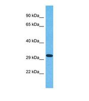 OR6N2 Antibody - Western blot of Human Jurkat. OR6N2 antibody dilution 1.0 ug/ml.  This image was taken for the unconjugated form of this product. Other forms have not been tested.