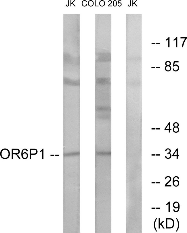 OR6P1 Antibody - Western blot analysis of lysates from Jurkat and COLO cells, using OR6P1 Antibody. The lane on the right is blocked with the synthesized peptide.