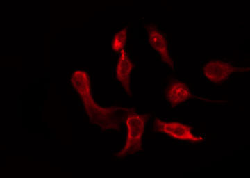 OR6P1 Antibody - Staining HeLa cells by IF/ICC. The samples were fixed with PFA and permeabilized in 0.1% Triton X-100, then blocked in 10% serum for 45 min at 25°C. The primary antibody was diluted at 1:200 and incubated with the sample for 1 hour at 37°C. An Alexa Fluor 594 conjugated goat anti-rabbit IgG (H+L) Ab, diluted at 1/600, was used as the secondary antibody.
