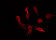 OR6P1 Antibody - Staining HeLa cells by IF/ICC. The samples were fixed with PFA and permeabilized in 0.1% Triton X-100, then blocked in 10% serum for 45 min at 25°C. The primary antibody was diluted at 1:200 and incubated with the sample for 1 hour at 37°C. An Alexa Fluor 594 conjugated goat anti-rabbit IgG (H+L) Ab, diluted at 1/600, was used as the secondary antibody.