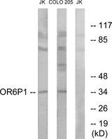 OR6P1 Antibody - Western blot analysis of extracts from Jurkat cells and COLO cells, using OR6P1 antibody.