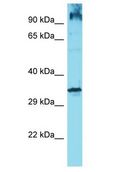 OR6Q1 Antibody - OR6Q1 antibody Western Blot of Jurkat. Antibody dilution: 1 ug/ml.  This image was taken for the unconjugated form of this product. Other forms have not been tested.