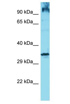 OR6Q1 Antibody - OR6Q1 antibody Western Blot of Jurkat. Antibody dilution: 1 ug/ml.  This image was taken for the unconjugated form of this product. Other forms have not been tested.