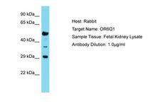OR6Q1 Antibody -  This image was taken for the unconjugated form of this product. Other forms have not been tested.