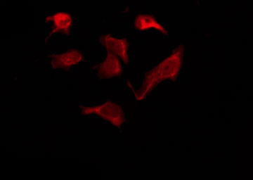 OR6Q1 Antibody - Staining HeLa cells by IF/ICC. The samples were fixed with PFA and permeabilized in 0.1% Triton X-100, then blocked in 10% serum for 45 min at 25°C. The primary antibody was diluted at 1:200 and incubated with the sample for 1 hour at 37°C. An Alexa Fluor 594 conjugated goat anti-rabbit IgG (H+L) Ab, diluted at 1/600, was used as the secondary antibody.