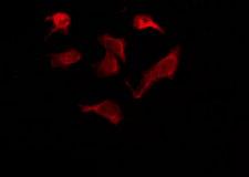 OR6Q1 Antibody - Staining HeLa cells by IF/ICC. The samples were fixed with PFA and permeabilized in 0.1% Triton X-100, then blocked in 10% serum for 45 min at 25°C. The primary antibody was diluted at 1:200 and incubated with the sample for 1 hour at 37°C. An Alexa Fluor 594 conjugated goat anti-rabbit IgG (H+L) Ab, diluted at 1/600, was used as the secondary antibody.