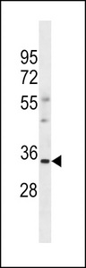 OR6S1 Antibody - OR6S1 Antibody western blot of human Uterus tissue lysates (35 ug/lane). The OR6S1 antibody detected the OR6S1 protein (arrow).
