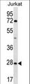 OR6T1 Antibody - OR6T1 Antibody western blot of Jurkat cell line lysates (35 ug/lane). The OR6T1 antibody detected the OR6T1 protein (arrow).
