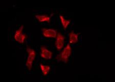 OR6T1 Antibody - Staining HeLa cells by IF/ICC. The samples were fixed with PFA and permeabilized in 0.1% Triton X-100, then blocked in 10% serum for 45 min at 25°C. The primary antibody was diluted at 1:200 and incubated with the sample for 1 hour at 37°C. An Alexa Fluor 594 conjugated goat anti-rabbit IgG (H+L) Ab, diluted at 1/600, was used as the secondary antibody.