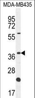 OR6V1 Antibody - OR6V1 Antibody western blot of MDA-MB435 cell line lysates (35 ug/lane). The OR6V1 antibody detected the OR6V1 protein (arrow).