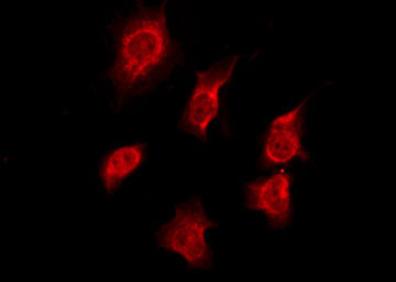 OR7C1 Antibody - Staining HeLa cells by IF/ICC. The samples were fixed with PFA and permeabilized in 0.1% Triton X-100, then blocked in 10% serum for 45 min at 25°C. The primary antibody was diluted at 1:200 and incubated with the sample for 1 hour at 37°C. An Alexa Fluor 594 conjugated goat anti-rabbit IgG (H+L) Ab, diluted at 1/600, was used as the secondary antibody.