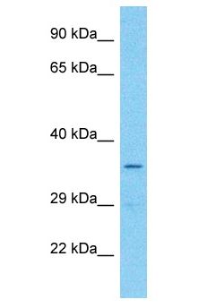 OR7E24 Antibody - OR7E24 antibody Western Blot of 721_B. Antibody dilution: 1 ug/ml.  This image was taken for the unconjugated form of this product. Other forms have not been tested.