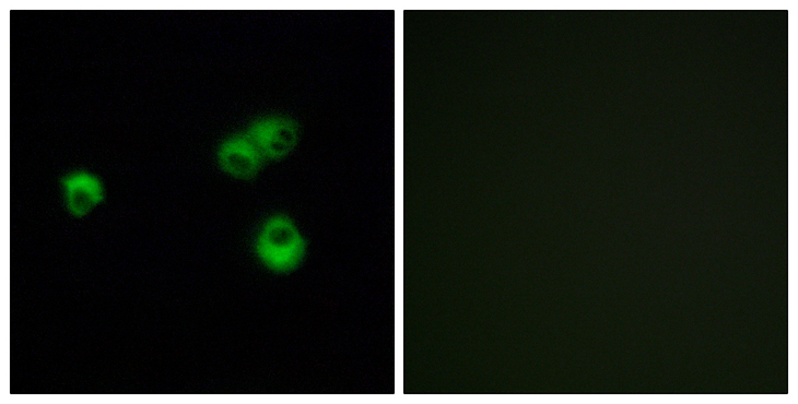 OR7E5P Antibody - Immunofluorescence analysis of MCF-7 cells, using OR7E5P Antibody. The picture on the right is blocked with the synthesized peptide.