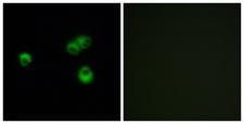 OR7E5P Antibody - Immunofluorescence analysis of MCF-7 cells, using OR7E5P Antibody. The picture on the right is blocked with the synthesized peptide.